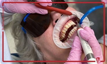 تحلیل استخوان اطراف دندان: علل، علائم و راهکارهای درمانی